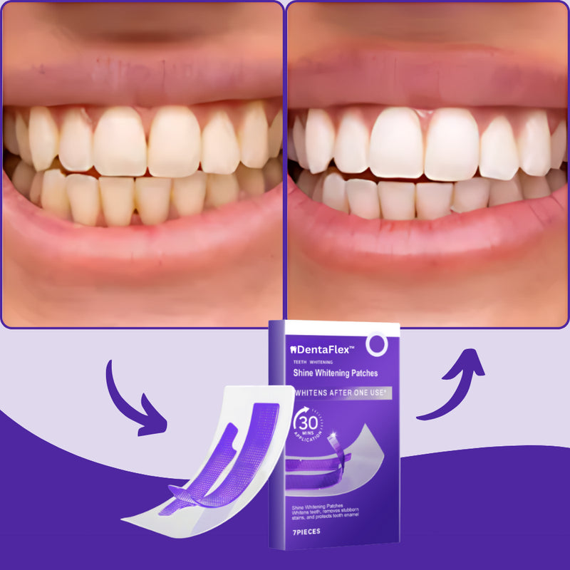 Product feature image