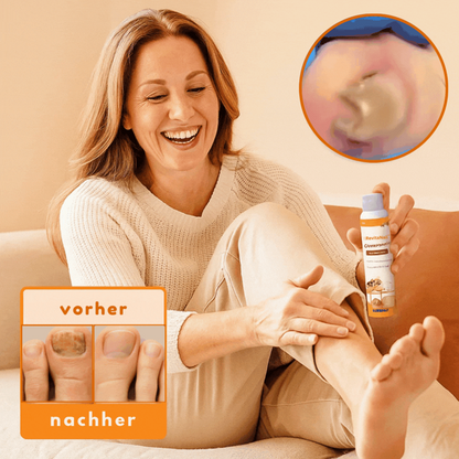 Revitanail™ – Grey Nail Treatment Spray