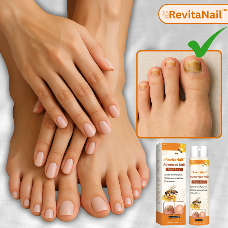 Revitanail™ – Grey Nail Treatment Spray